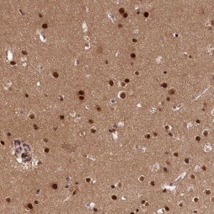 Anti-ADIG antibody produced in rabbit 