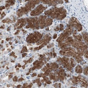 Anti-ADNP2 antibody produced in rabbit 