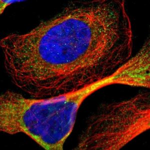 Anti-ADNP2 antibody produced in rabbit 