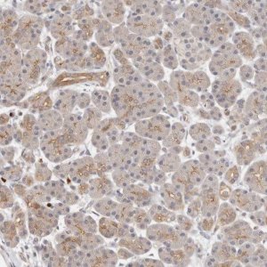Anti-AFDN antibody produced in rabbit 