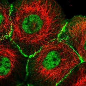 Anti-AFDN antibody produced in rabbit 