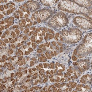 Anti-AFP antibody produced in rabbit HPA023600-100UL