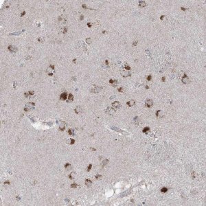 Anti-AGPS antibody produced in rabbit 