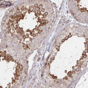 Anti-AGTPBP1 antibody produced in rabbit 