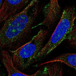 Anti-AGTPBP1 antibody produced in rabbit 