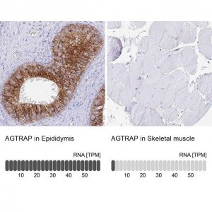 Anti-AGTRAP antibody produced in rabbit 
