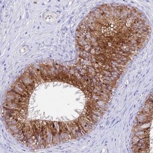 Anti-AGTRAP antibody produced in rabbit 