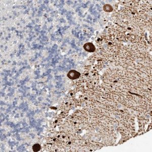 Anti-AIDA antibody produced in rabbit HPA027935-100UL