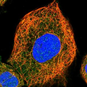 Anti-AIDA antibody produced in rabbit HPA027935-100UL