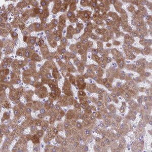 Anti-AIG1 antibody produced in rabbit 
