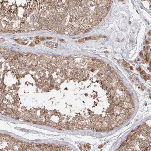 Anti-AIM2 antibody produced in rabbit 