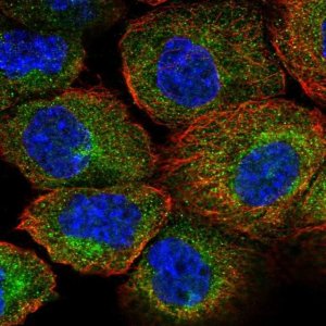 Anti-AIP antibody produced in rabbit 
