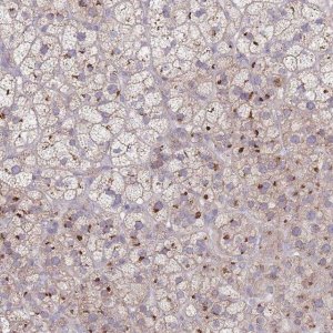 Anti-AKAIN1 antibody produced in rabbit 