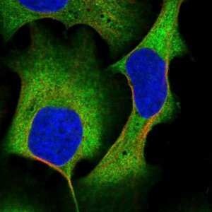 Anti-AKAP10 antibody produced in rabbit 