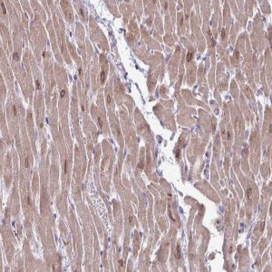 Anti-AKAP6 antibody produced in rabbit 