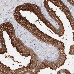 Anti-AKNAD1 antibody produced in rabbit 