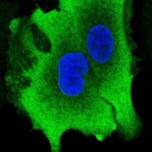 Anti-AKR1B10 antibody produced in rabbit 