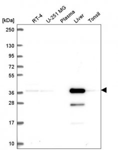 Anti-AKR7A2 antibody produced in rabbit 