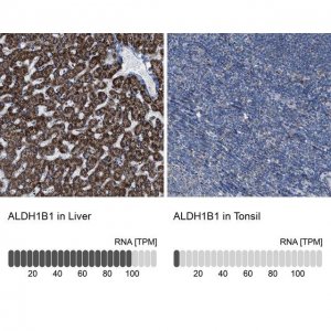 Anti-ALDH1B1 antibody produced in rabbit 
