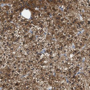 Anti-ALDH3A2 antibody produced in rabbit 