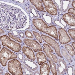 Anti-ALG3 antibody produced in rabbit 
