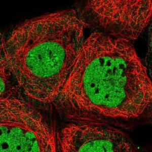 Anti-ALG8 antibody produced in rabbit HPA051898-100UL