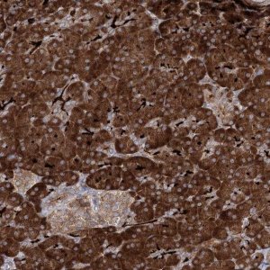 Anti-ALG9 antibody produced in rabbit 