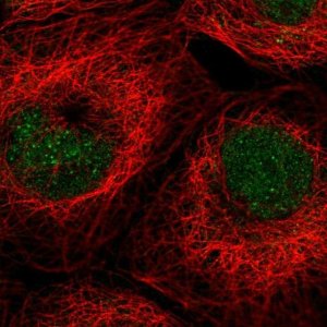 Anti-ALKBH3 antibody produced in rabbit 
