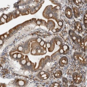 Anti-ALPK2 antibody produced in rabbit 