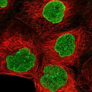 Anti-AMPD3 antibody produced in rabbit 