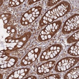 Anti-ANAPC4 antibody produced in rabbit 