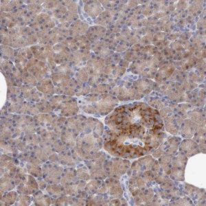 Anti-ANGEL1 antibody produced in rabbit 