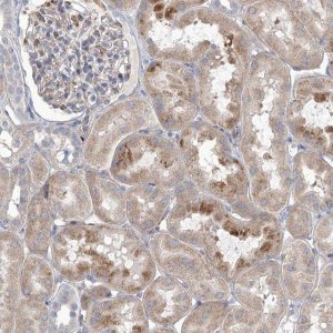 Anti-ANGPTL3 antibody produced in rabbit 