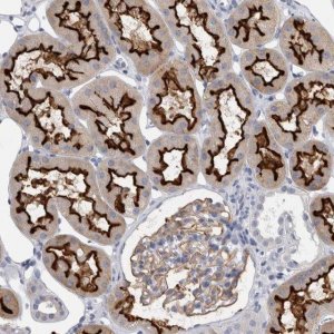 Anti-ANKFY1 antibody produced in rabbit HPA024513-100UL