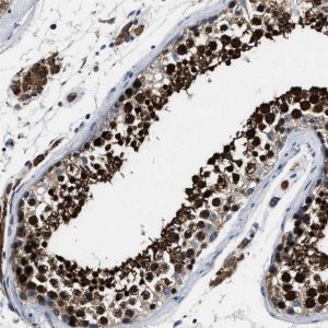Anti-ANKIB1 antibody produced in rabbit 
