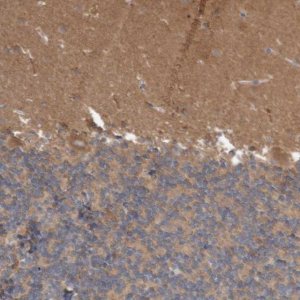 Anti-ANKK1 antibody produced in rabbit 