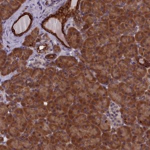 Anti-ANKRD39 antibody produced in rabbit 