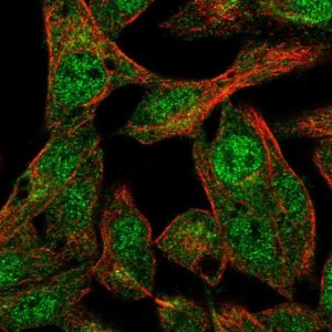 Anti-ANKS4B antibody produced in rabbit 