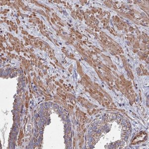 Anti-ANO10 antibody produced in rabbit 