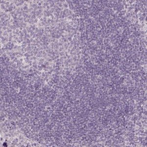 Anti-ANO2 antibody produced in rabbit 