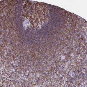 Anti-AP5M1 antibody produced in rabbit HPA055768-100UL