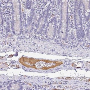 Anti-APOB antibody produced in rabbit 