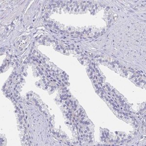 Anti-APOB antibody produced in rabbit 