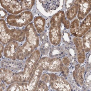 Anti-APRT antibody produced in rabbit HPA026681-100UL