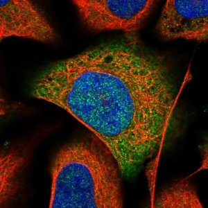 Anti-APRT antibody produced in rabbit HPA026681-100UL