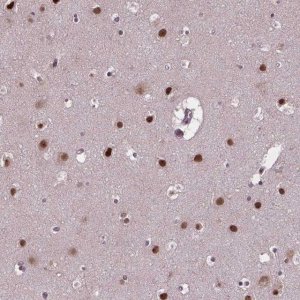 Anti-APTX antibody produced in rabbit 