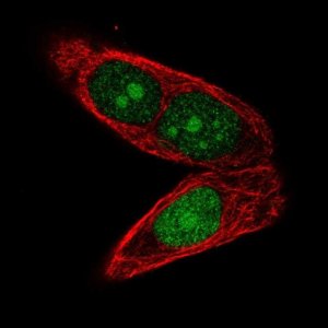 Anti-APTX antibody produced in rabbit 