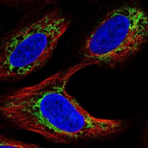 Anti-AR antibody produced in rabbit 