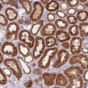 Anti-ARAP1 antibody produced in rabbit 