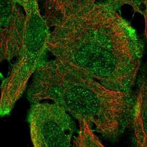 Anti-ARAP1 antibody produced in rabbit 